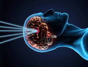 Perkütan Girişimler ve Damar Hastalıkları Tedavisi