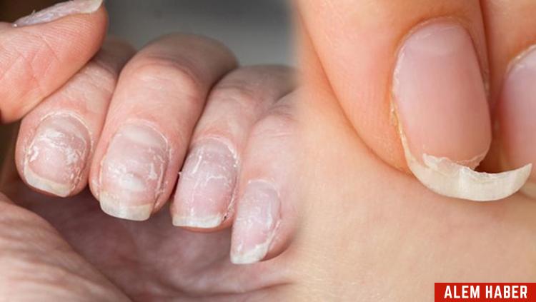Tırnak Bakımı İpuçları