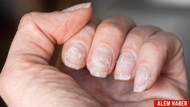 Tırnak Bakımı İpuçları