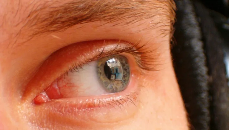 Rüyada Aslan Görmek ve Finansal Durumun Bağlantısı